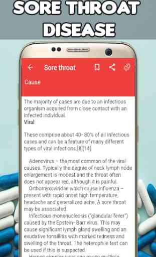 Sore Throat: Causes, Diagnosis, and Management 2