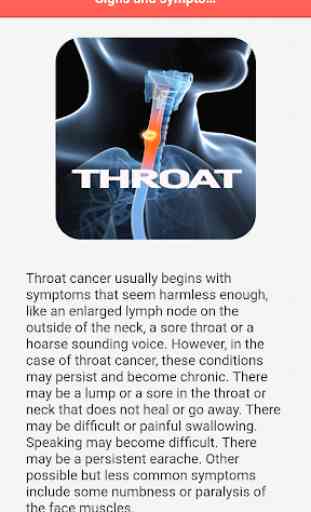 Throat Cancer 4