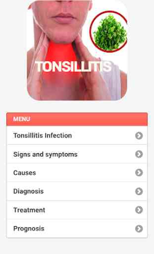 Tonsillitis Infection 3