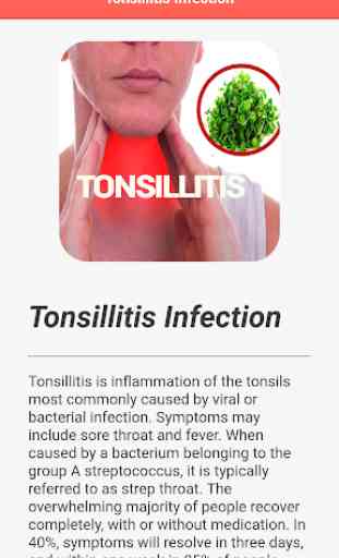 Tonsillitis Infection 4